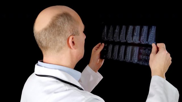 Doctor looking x-ray of backbones isolated on black background. Surgeon in medical gown examining spine bones on x-ray picture