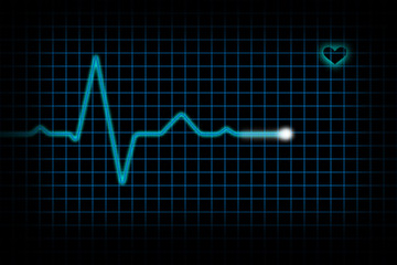 Electrocardiogram EKG