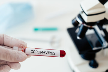 Coronavirus blood test concept. Doctor hand in medical glove holding test tube with Coronavirus positive blood over laboratory desk. 2019-nCoV Coronavirus originating in Wuhan, China