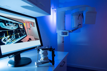 Artikulator mit Gipsmodell und Aufbissschiene und 3d Röntgengerät in der Zahnarzt Praxis