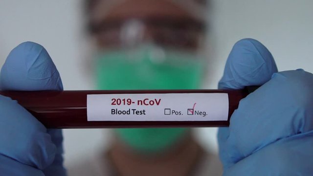 Slow motion of scientist with coronavirus Covid 19 Negative infected blood sample in tube. Vaccine research of virus 2019-nCoV at laboratory. Disease 2019 from Wuhan. Pandemic infectious concept-Dan