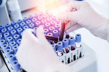 Nurse microbiologist holding test tube with blood for coronavirus 2019-nCoV analyzing