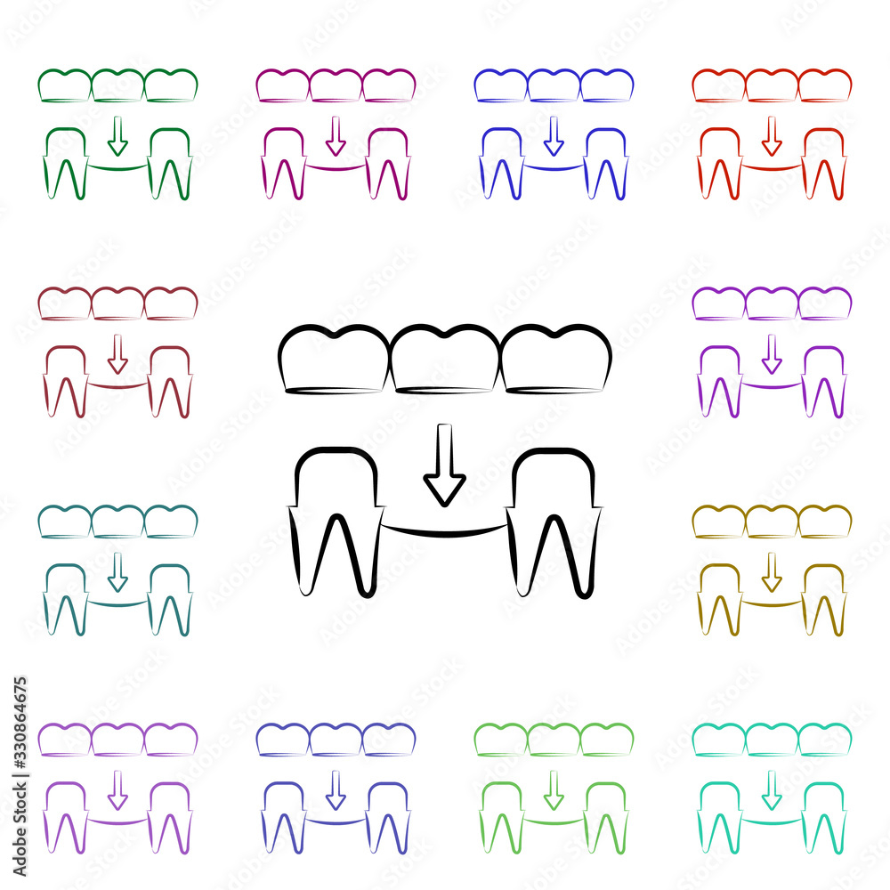 Poster implant, prosthesis multi color style icon. simple thin line, outline vector of dentist icons for ui