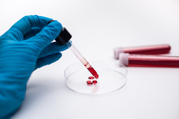 Wissenschaftler testet Blut in einer Petrischale 