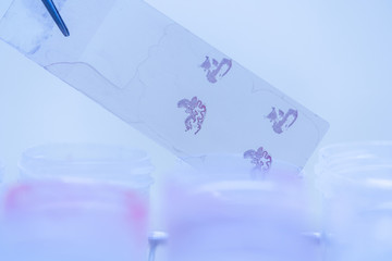 Scientist is preparing a tumor slide. Microscopy of cytopathology slides and pathology.