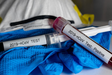 Blood samples that have tested positive for the Coronavirus