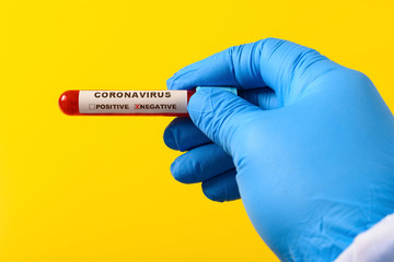 Fototapeta premium doctor holding a coronavirus blood test tube with result of negative the X has clipping path and can be removed