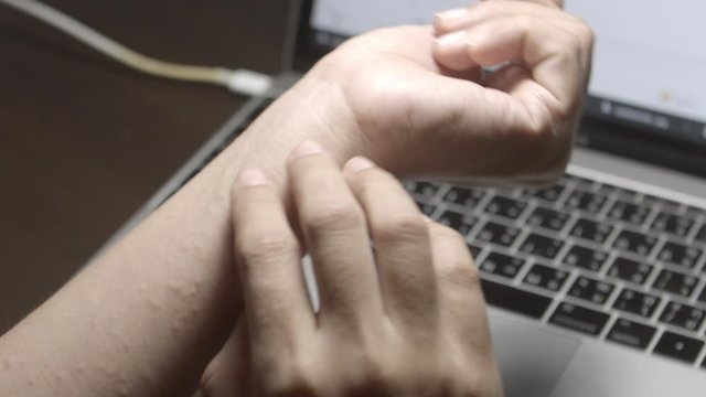 hand itching cause eczema while working with laptop , cu shot