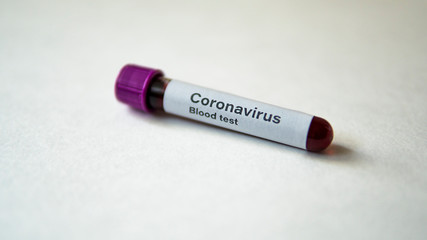 A blood test sample for coronavirus