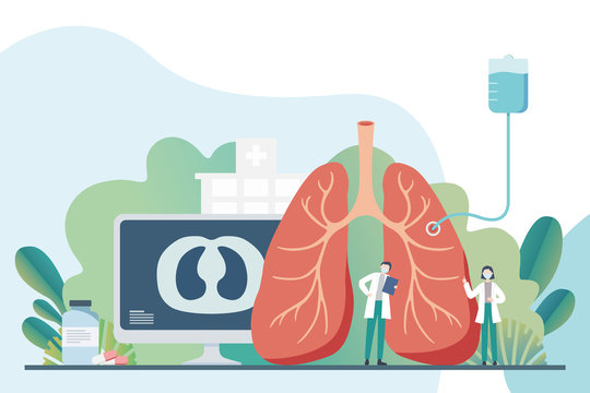 Covid-19 Medical Illustration.Doctors And Nurses Treat The Lung. Covid-19 Medical Illustration. CT Scan Of The Lung.