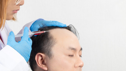 Close up of a bald man receiving injection in scalp from doctor. Man's head with gloves holding syringe on white background. Hair loss problem, alopecia treatment and hair growth concept.