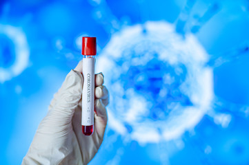 A blood test for COVID-19 in the hand of a medic with a latex glove. The concept of coronavirus...