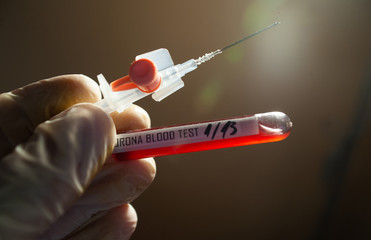 Doctors are analyzing Search for Covid's Anti-Virus Serum By studying the infection from photos of...