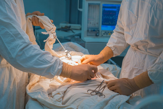 close-up hands of pediatric surgeons perform surgery using laparoscopic ports for endoscopic surgery. In a sterile operating room. Pediatric surgery, treatment of inguinal hernia in children by PIRS