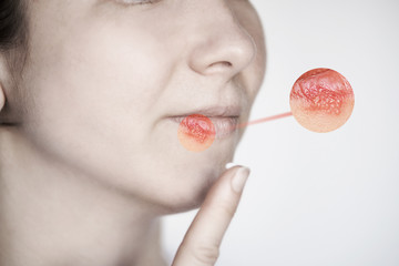 Girl with herpes. Sick mouth symptom. Lips cold. Red round concept. Finger near head. Woman face. Healthcare infection. Close view