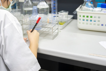 Scientist holding Test tube with blood sample for COVID-19 test,Experiment to detect virus was found in the blood,Developers of potential medicines and vaccines against COVID-19