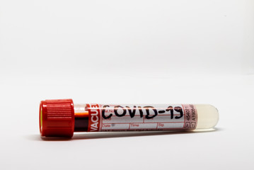 COVID- 19. Corona virus disease. Blood test. Stop dangerous Chinese virus COVID-19.Laboratory sample of blood testing for diagnosis new Corona virus infection.