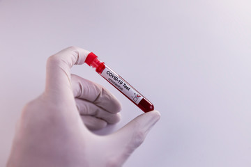 Doctor holds A COVID-19 coronavirus blood sample in his hand. The patient were tested positive for the virus. Health Concept.