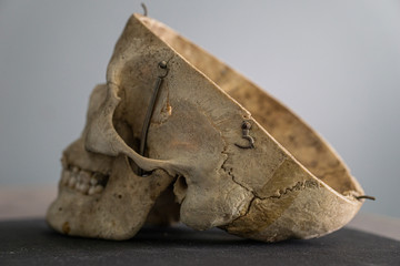 skull head bones isolated