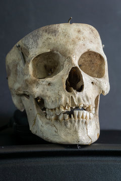 skull head bones isolated