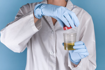 doctor in a white uniform and blue gloves on a blue background holds an open plastic jar with yellow urine. a test for a disease