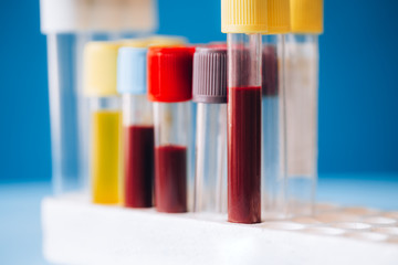 blood tubes and empty tubes in a tray on a blue background