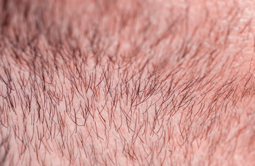 background with a man's chin skin texture covered with hair and beard bristles