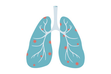 vector illustration of coronavirus-infected lungs