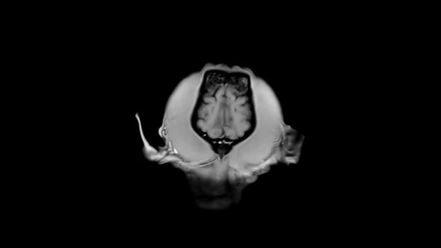 A Tomography Scan of A Dog's Head. Magnetic Resonance of a dog head.