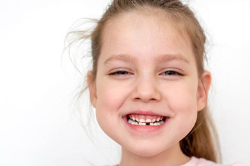 a happy girl in a pink school- age t-shirt without a front tooth laughs. To close. Diphyodont. Isolated on a white background. health