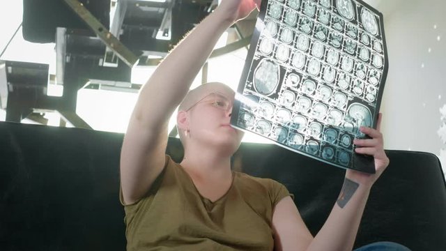 Portrait of pale woman sick with cancer, request for help, social protection. A bald girl with cancer or leukemia examines an MRI scan or X-ray. The woman underwent chemotherapy.