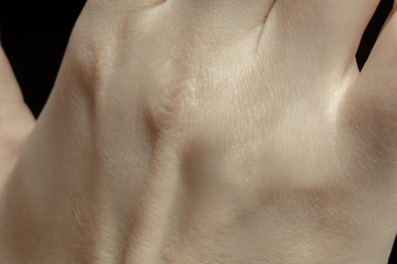 Hands. Detailed texture of human skin. Close up shot of young caucasian female body. Skincare, bodycare, healthcare, hygiene and medicine concept. Looks beauty and well-kept. Dermatology.