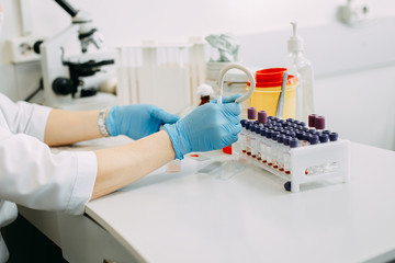 Blood test process in laboratory. Doctor hands making blood test. Many blood test-tubes with blood...