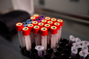 Test tubes with red caps for analysis. Laboratory of analysis and biological research. Close up
