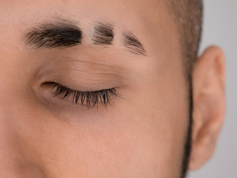Eyebrow with double scars, closed eye with natural long lashes, eyebrow slits