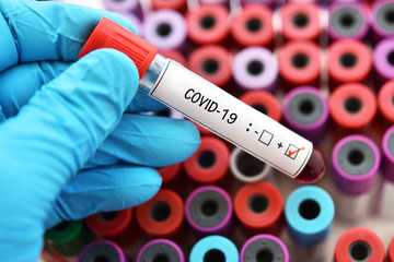Obraz premium Blood sample tube positive with COVID-19 virus or novel coronavirus 2019 found in Wuhan, China