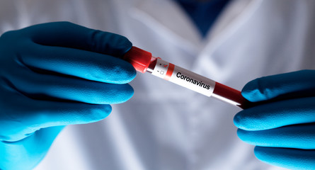 Coronavirus 2019-nCoV Blood Sample.