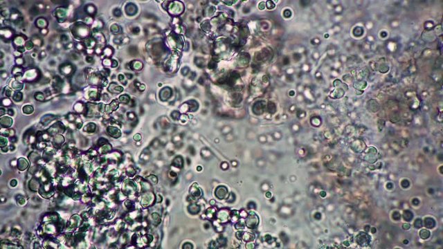 Clumps of sourdough round milk bacillus and sticks move quickly in microscope. Theme of lactic acid foods is under 1000x magnification. Bacteria useful for human body. Microcosmic background.