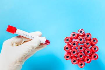 Search for a pandemic vaccine. Covid-19 coronavirus concept. Conceptual photo - health care to help...