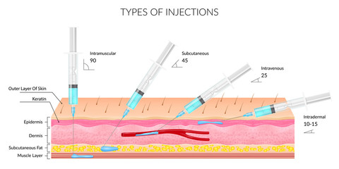 Types of different injections on a white background with the image of the structure of the skin and subcutaneous layers. Realistic vector illustration on a medical theme