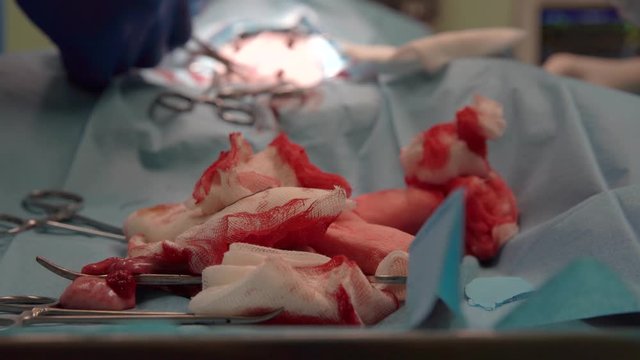 performing a surgical procedure using a tool such as a scalpel, clamps, scissors, disinfection and bandages. traces of blood