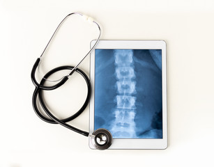 A tablet and a stethoscope against a white background