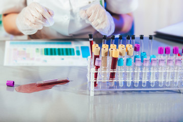 Scientist dropping liquid in a test tube in a laboratory. Accidents in the laboratory.