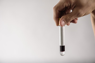 man's hand holding blood in a test tube close up, physical examination, sampling, checking for...