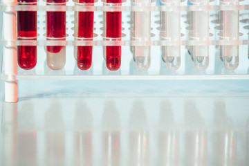 Test tubes. Medical equipment.Test tubes with colorful liquids in holder on table.