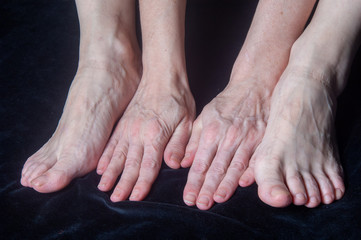 Pieds et mains cinquantaine