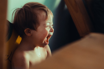 Niño sindrome de down