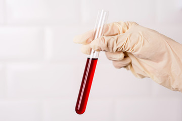 Laboratory technician holding a test tube with blood in laboratory.