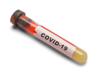 COVID-19 Blood Vial