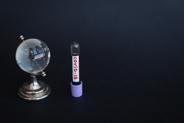 Coronavirus 2019-nCoV Blood Sample. Corona virus outbreaking. Epidemic virus Respiratory Syndrome....